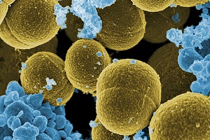 Staphylococcus aureau Magnification 20,000